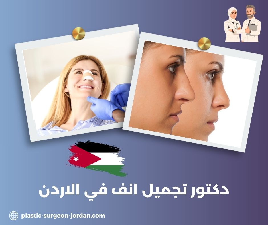 احسن دكتور تجميل انف في الاردن احسن دكتور تجميل انف في الاردن