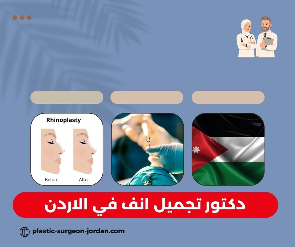 دكتور تجميل انف في تركيا دكتور تجميل انف في تركيا