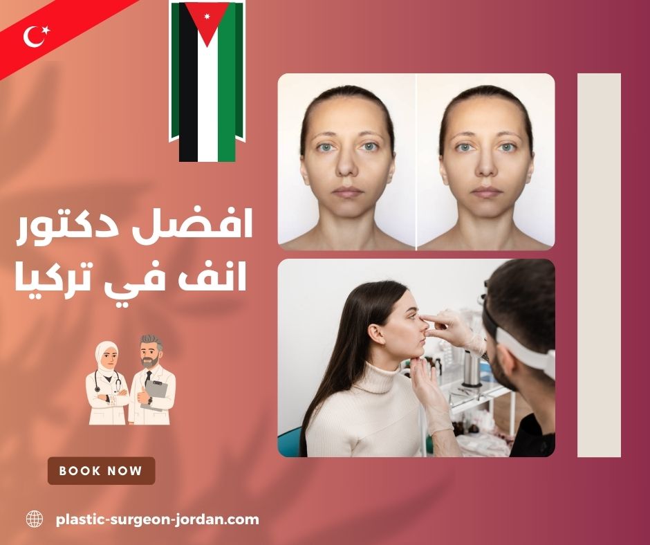 افضل دكتور انف في تركيا