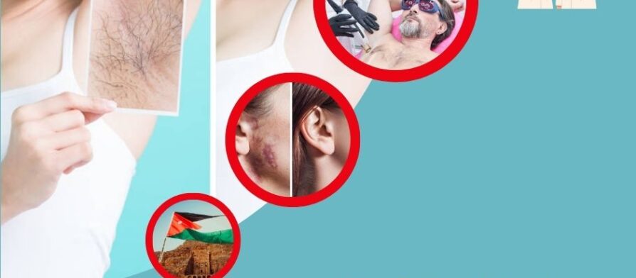 عيادات ليزر الاردن
