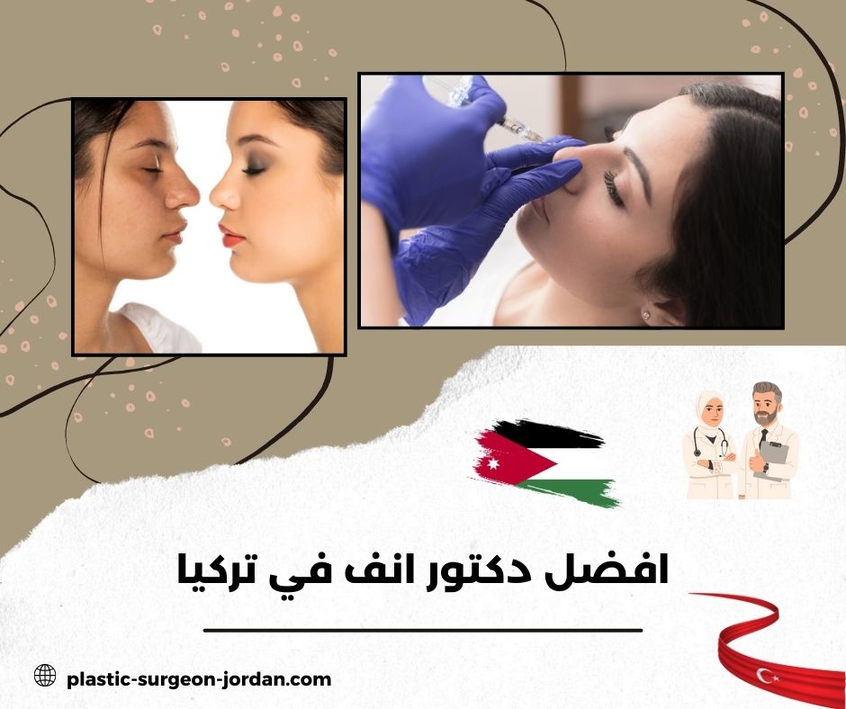 أفضل دكتور تجميل أنف في تركيا