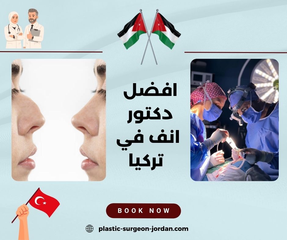 افضل دكتور تجميل انف تركيا