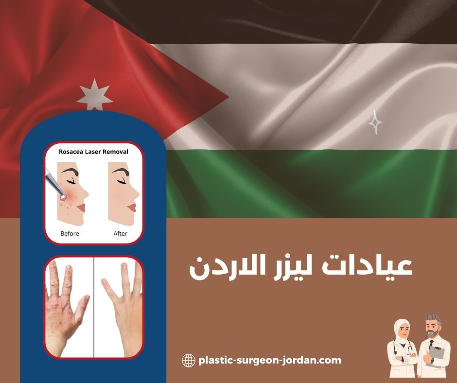 عيادات ليزر للرجال في الاردن