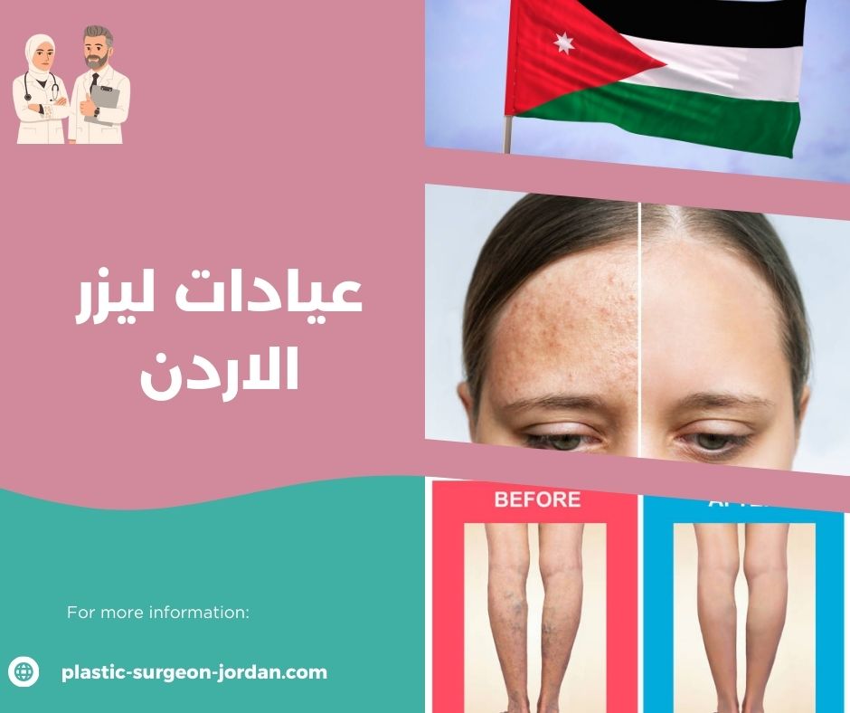 عيادات ليزر في عمان الاردن