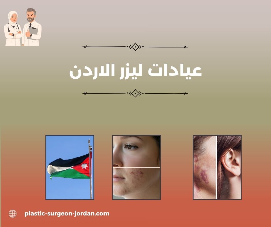 عيادات ليزر بالاردن