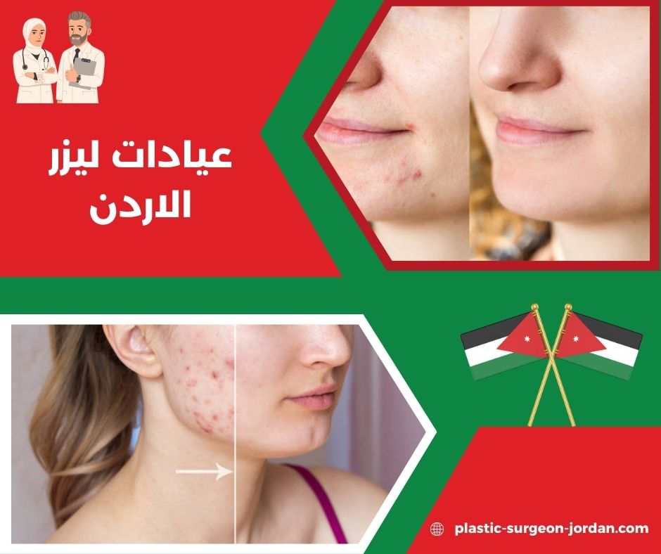عيادات ليزر الاردن