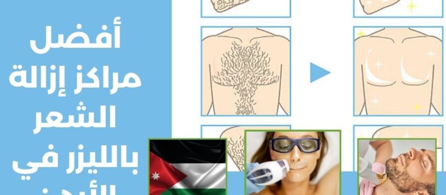 أفضل مراكز إزالة الشعر بالليزر في الأردن