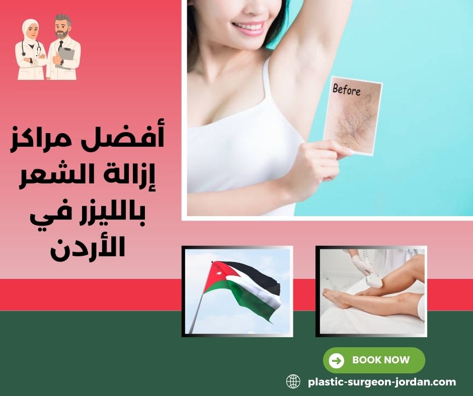 مراكز ازالة الشعر بالليزر عمان الاردن
