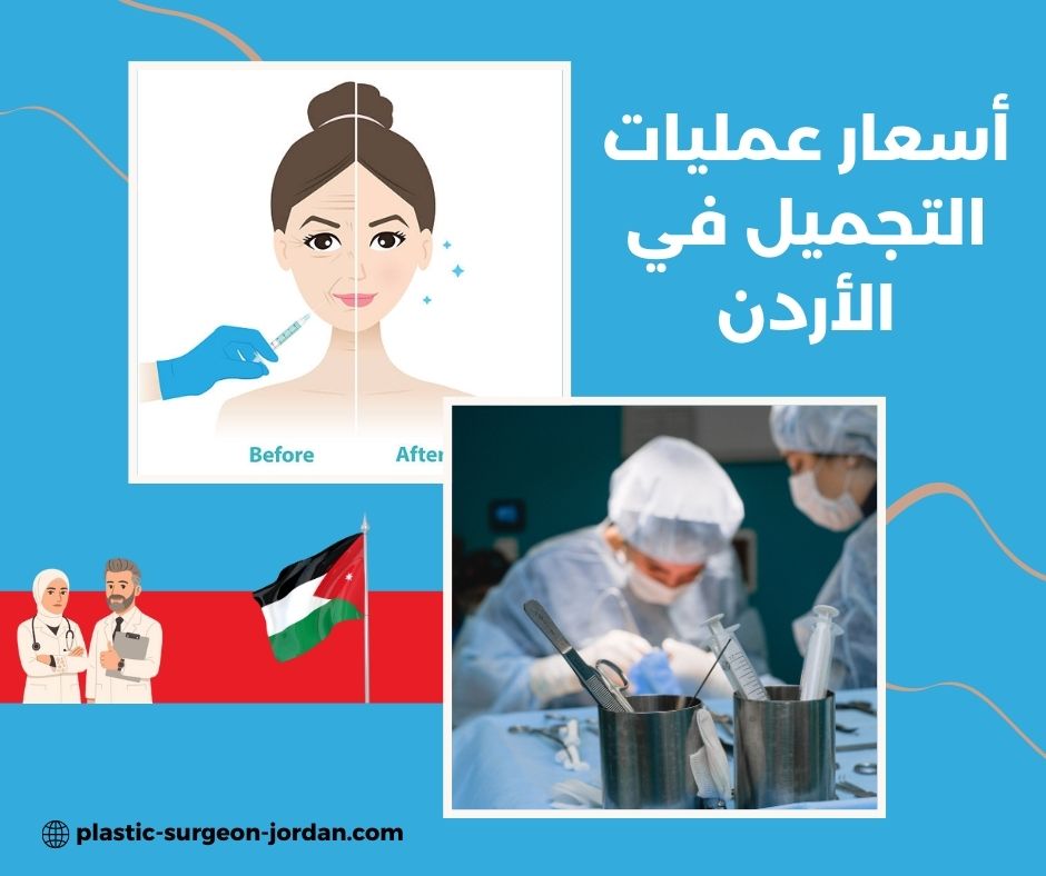 سعر ابرة النضارة للوجه في الأردن