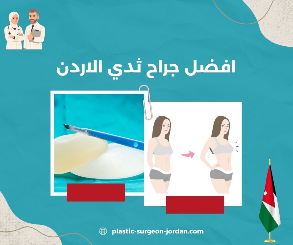 افضل جراح ثدي الاردن