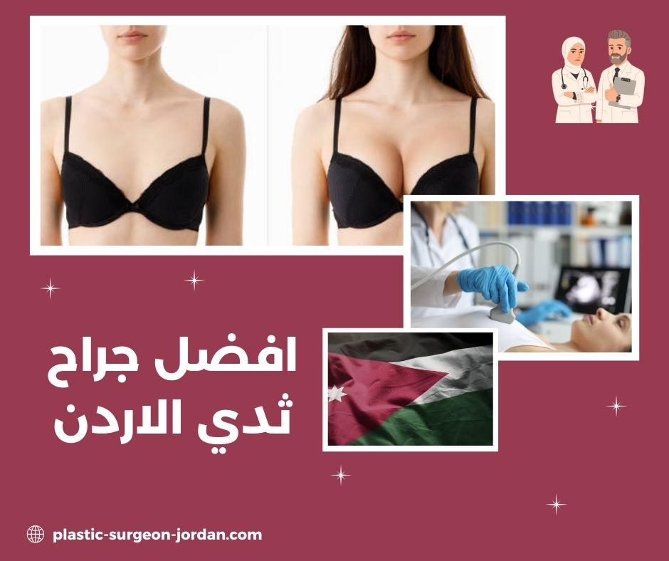 أفضل دكتور جراحة الثدي في الأردن