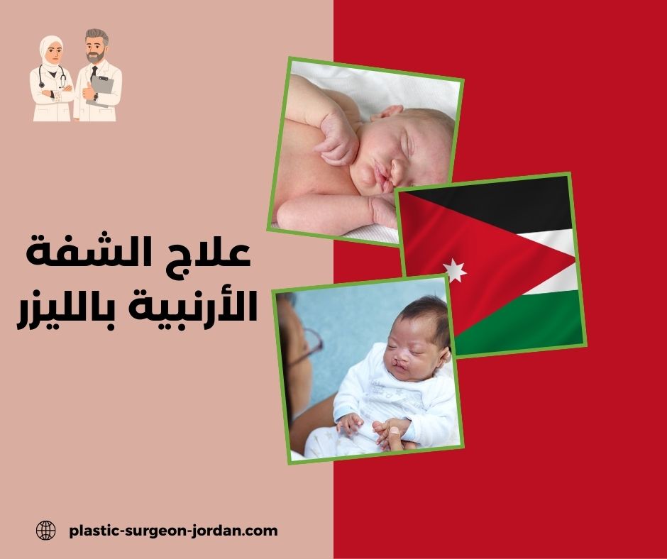 علاج الشفة الأرنبية بالليزر