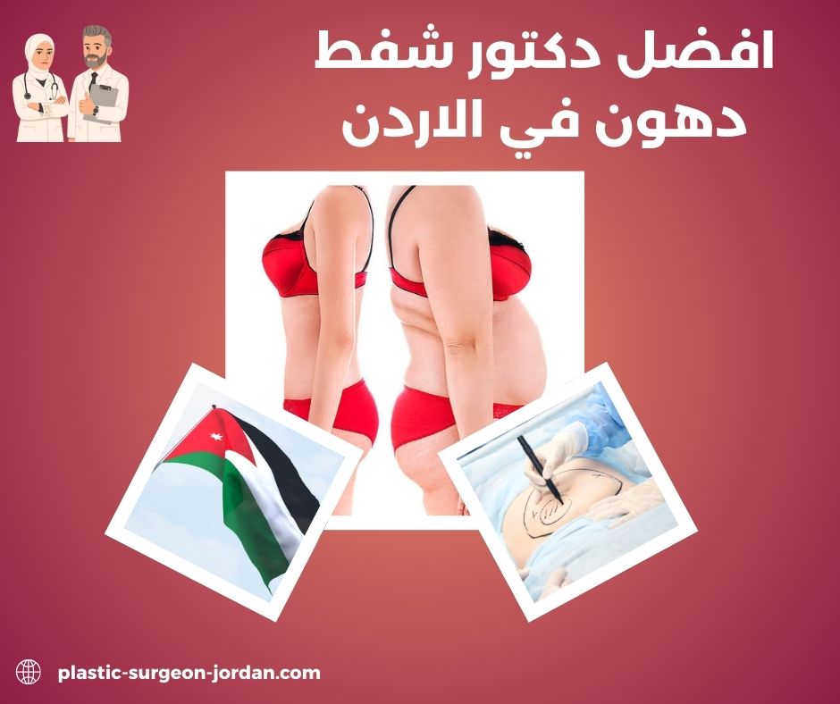 افضل دكتور شفط دهون في الاردن