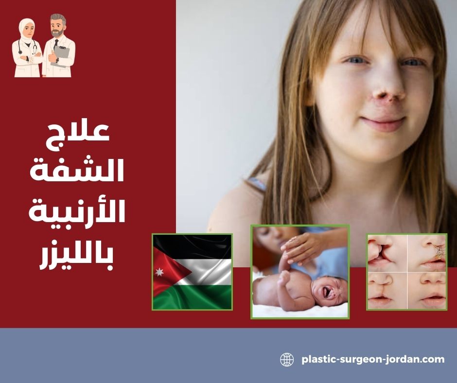 الشفة الأرنبية بعد التجميل للكبار