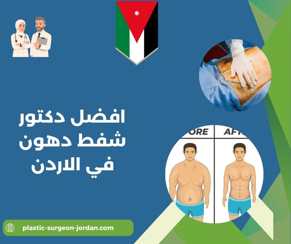 افضل دكتور تجميل شفط دهون في الاردن