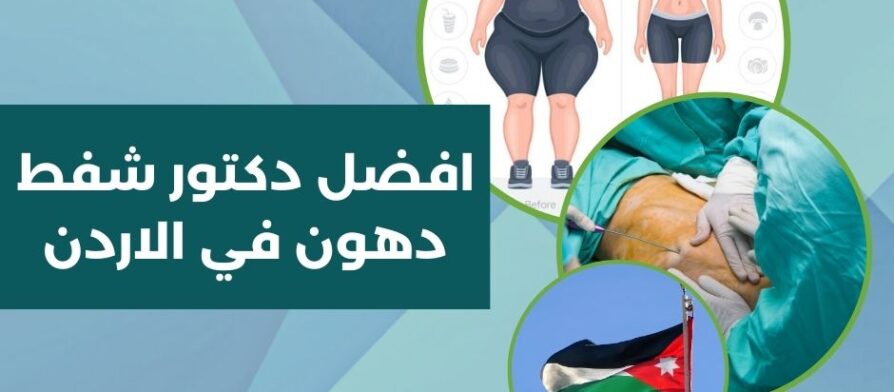افضل دكتور شفط دهون في الاردن