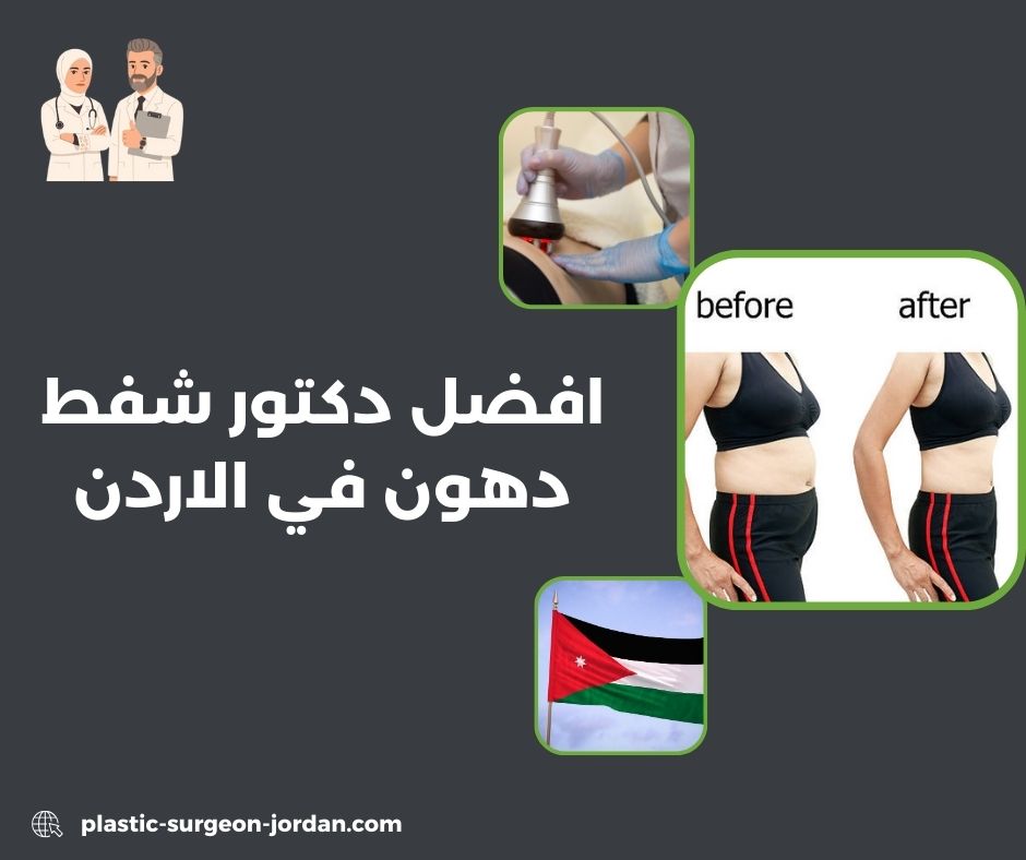 دكتور شفط دهون في الاردن
