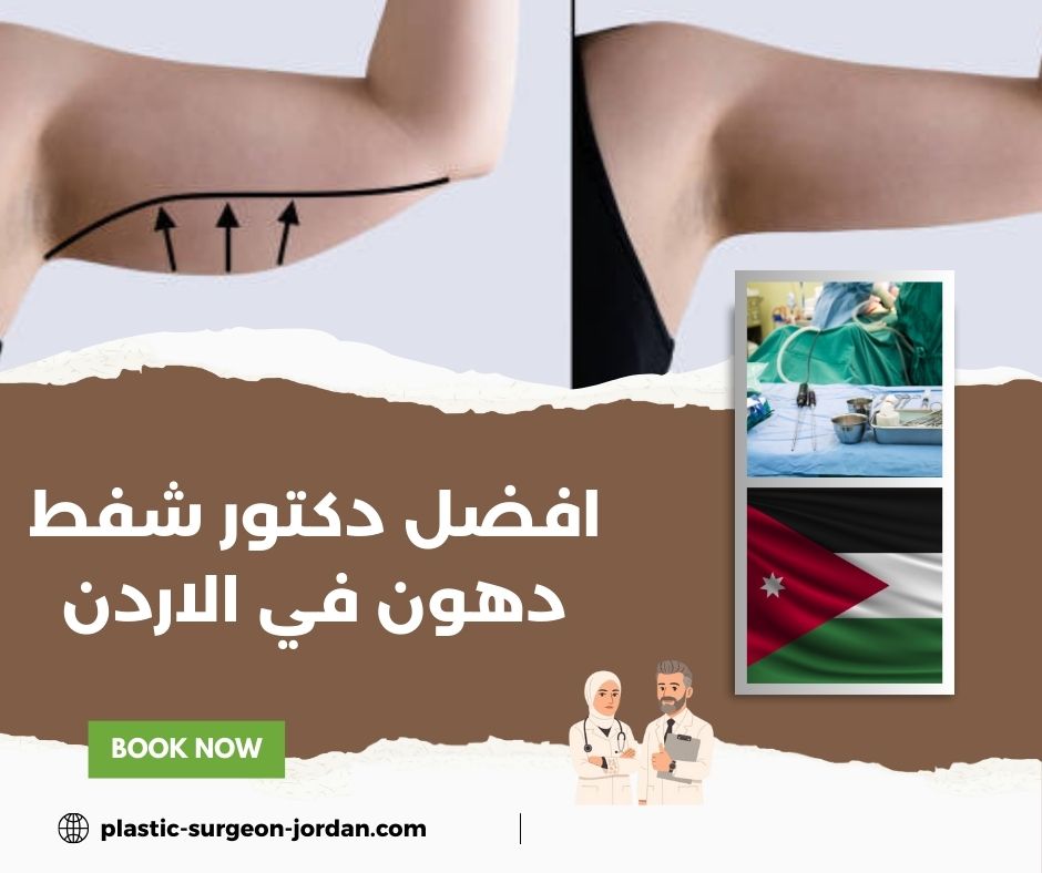 افضل دكتور شفط دهون في ايران