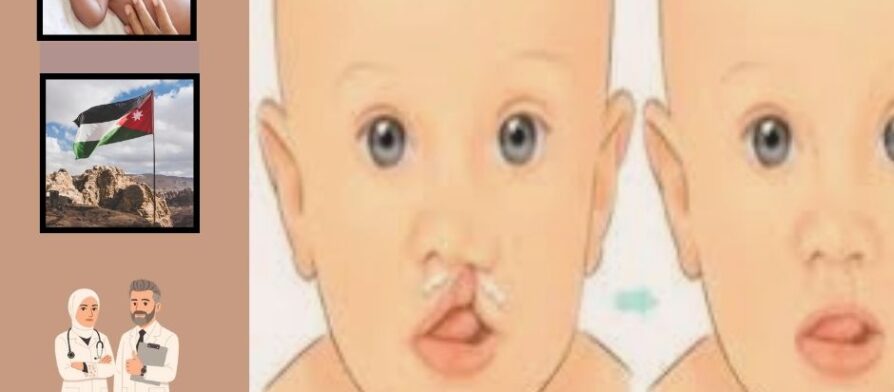 علاج الشفة الأرنبية بالليزر