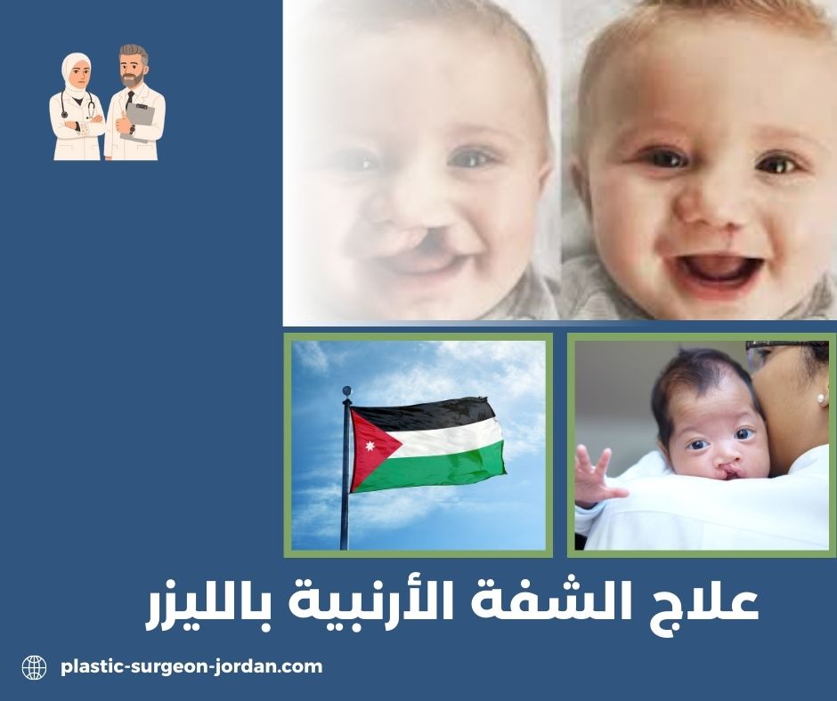 تكلفة عملية الشفة الأرنبية في السعودية