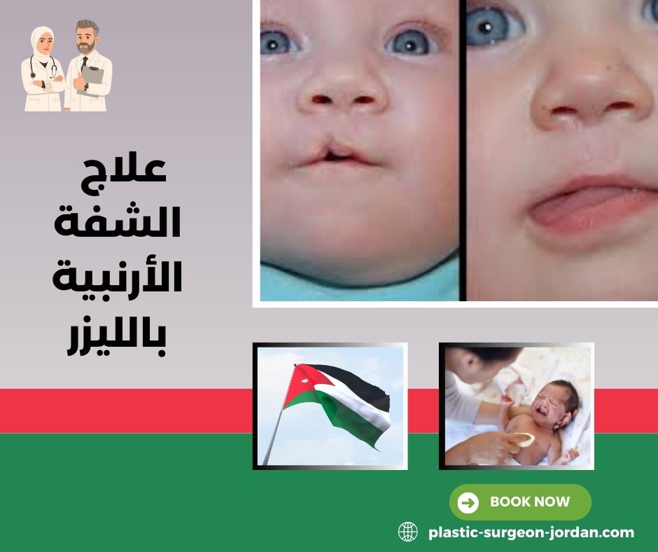 بعض تجارب الأهالي مع علاج الشفة الأرنبية بالليزر