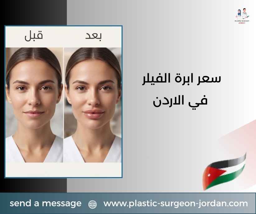 سعر ابرة الفيلر في الاردن سعر ابرة الفيلر في الاردن