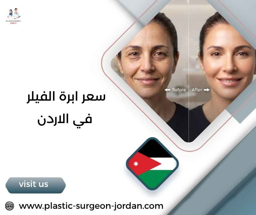 سعر ابرة الفيلر في الاردن سعر ابرة الفيلر في الاردن