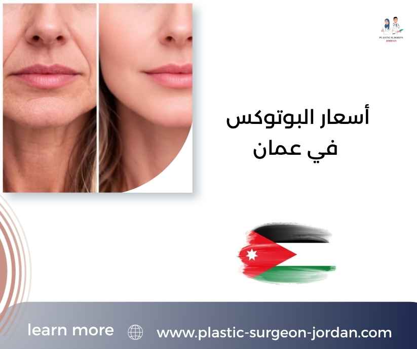 أسعار البوتوكس في عمان