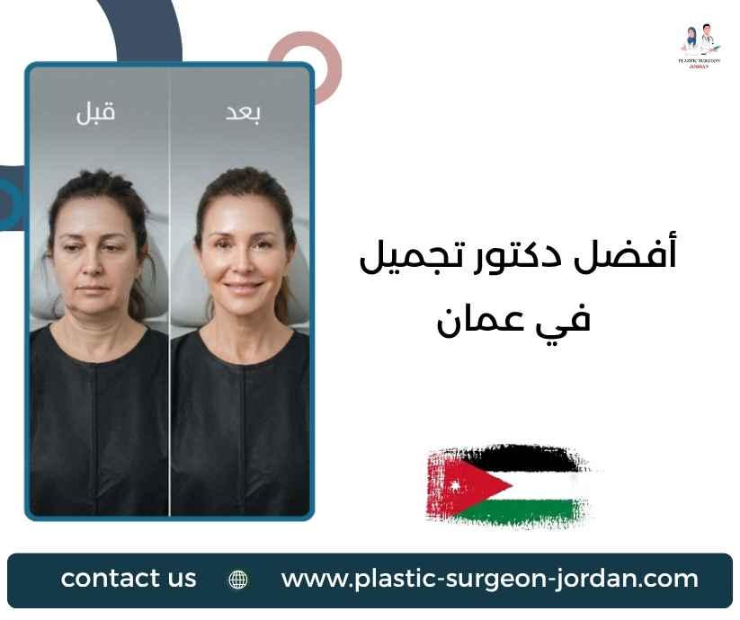 أفضل دكتور تجميل في عمان