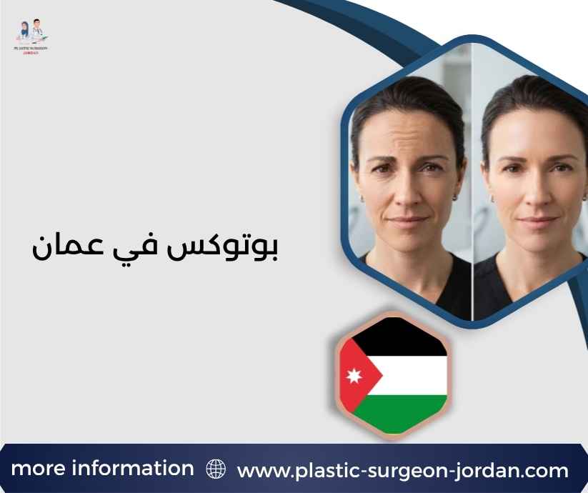 بوتوكس في عمان