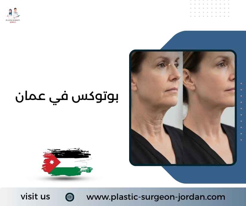 بوتوكس في عمان
