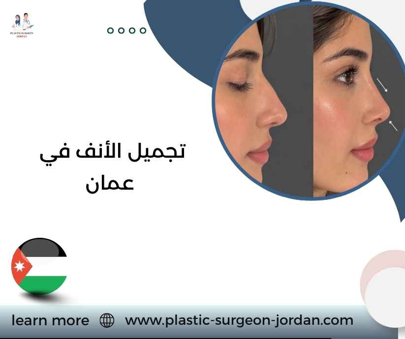 تجميل الأنف في عمان