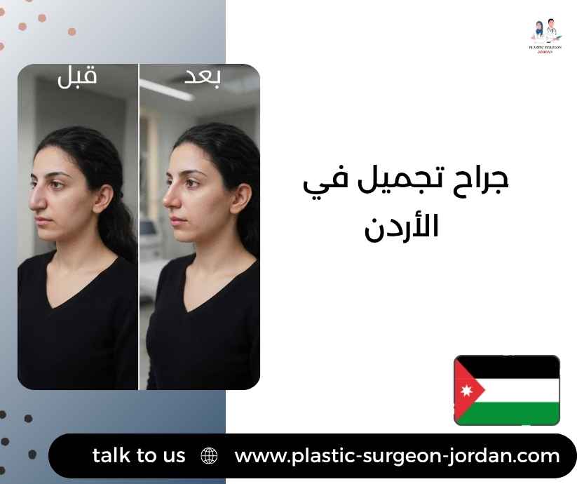 جراح تجميل في الأردن