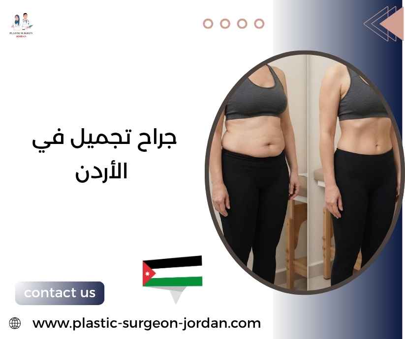 جراح تجميل في الأردن