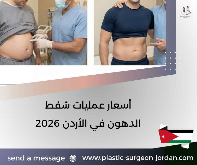أسعار عمليات شفط الدهون في الأردن 2026
