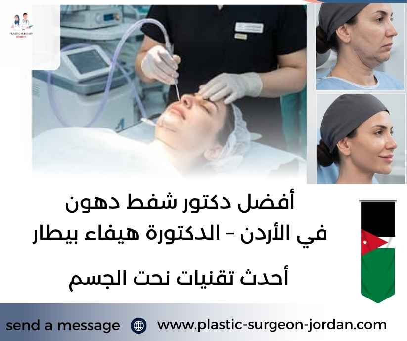 أفضل دكتور شفط دهون في الأردن – الدكتورة هيفاء بيطار