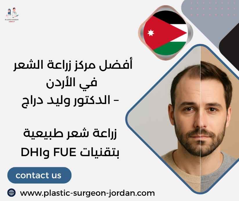 أفضل مركز زراعة الشعر في الأردن – الدكتور وليد دراج