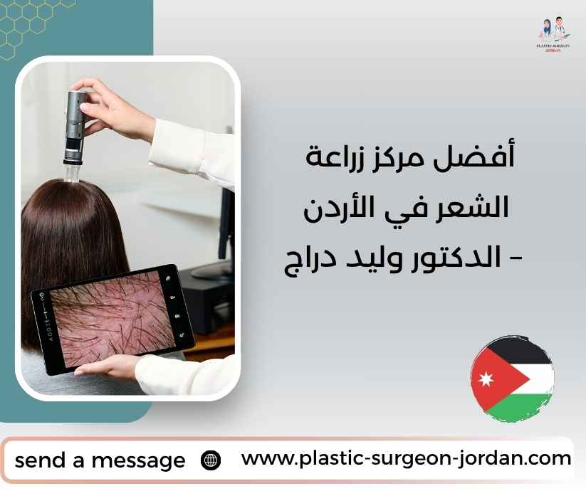 أفضل مركز زراعة الشعر في الأردن – الدكتور وليد دراج