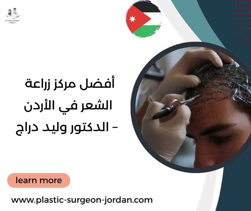 أفضل مركز زراعة الشعر في الأردن – الدكتور وليد دراج