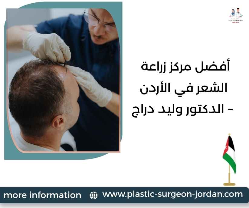 أفضل مركز زراعة الشعر في الأردن – الدكتور وليد دراج