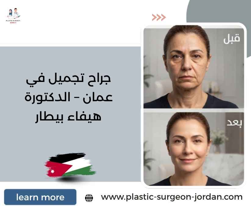 جراح تجميل في عمان – الدكتورة هيفاء بيطار جراح تجميل في عمان – الدكتورة هيفاء بيطار