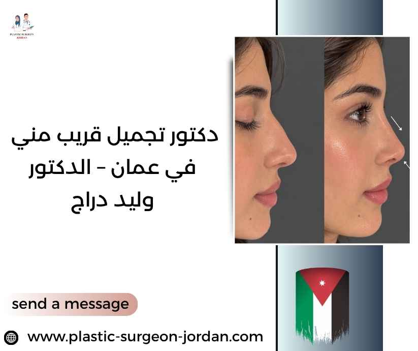 دكتور تجميل قريب مني في عمان – الدكتور وليد دراج