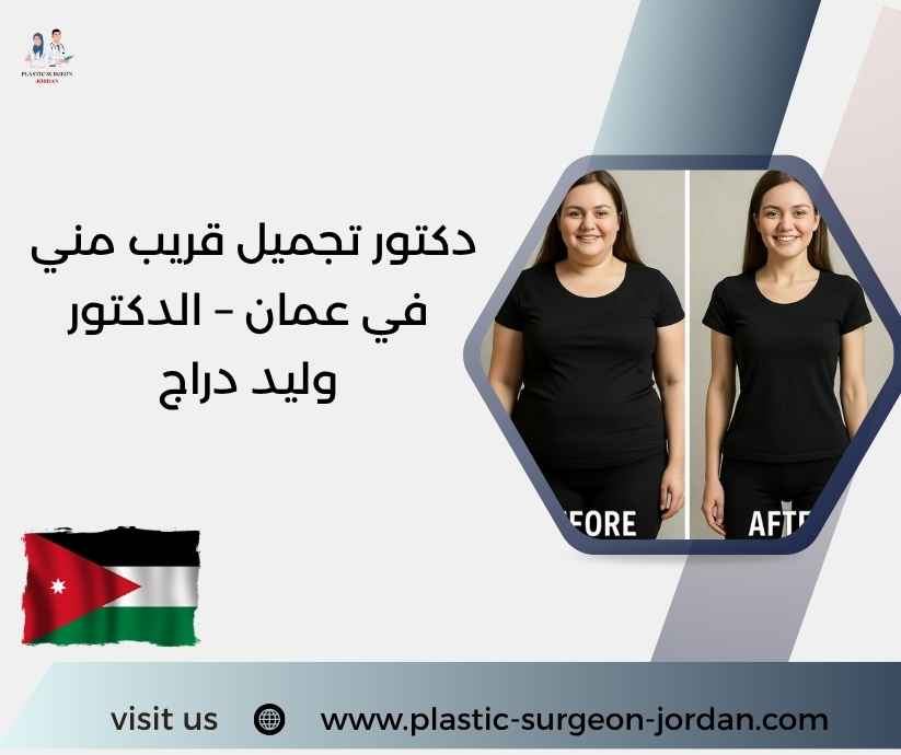 دكتور تجميل قريب مني في عمان – الدكتور وليد دراج