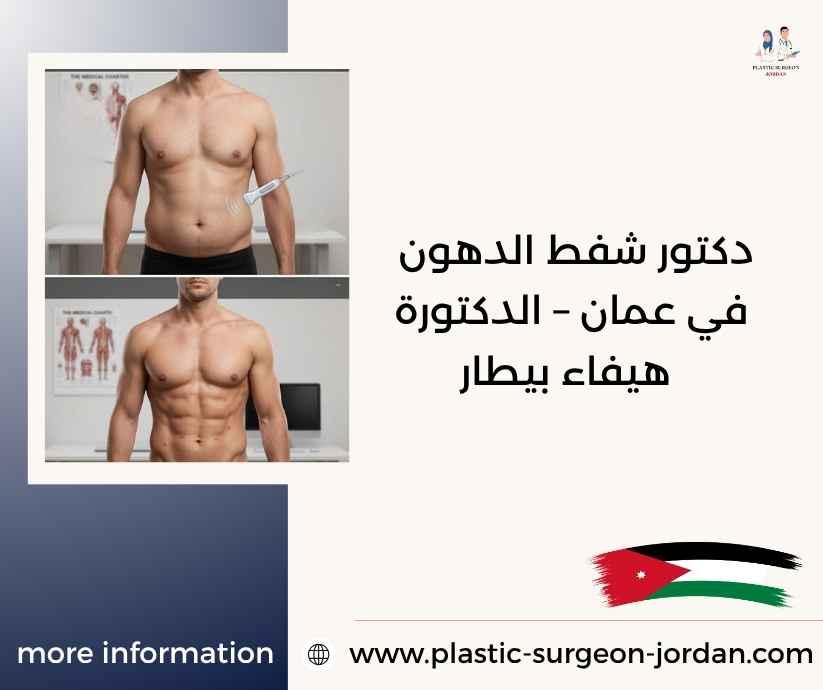 دكتور شفط الدهون في عمان – الدكتورة هيفاء بيطار دكتور شفط الدهون في عمان – الدكتورة هيفاء بيطار
