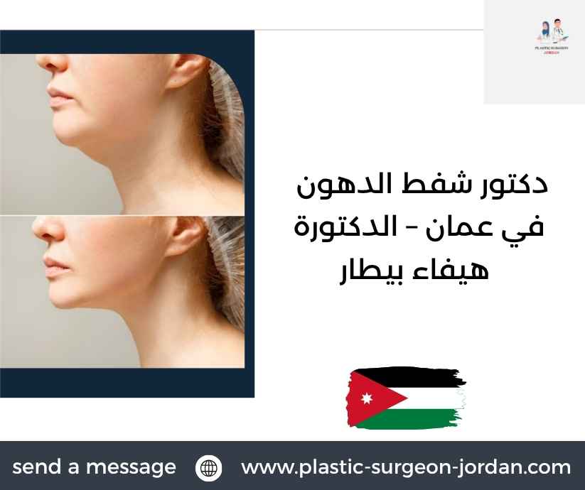 دكتور شفط الدهون في عمان – الدكتورة هيفاء بيطار دكتور شفط الدهون في عمان – الدكتورة هيفاء بيطار