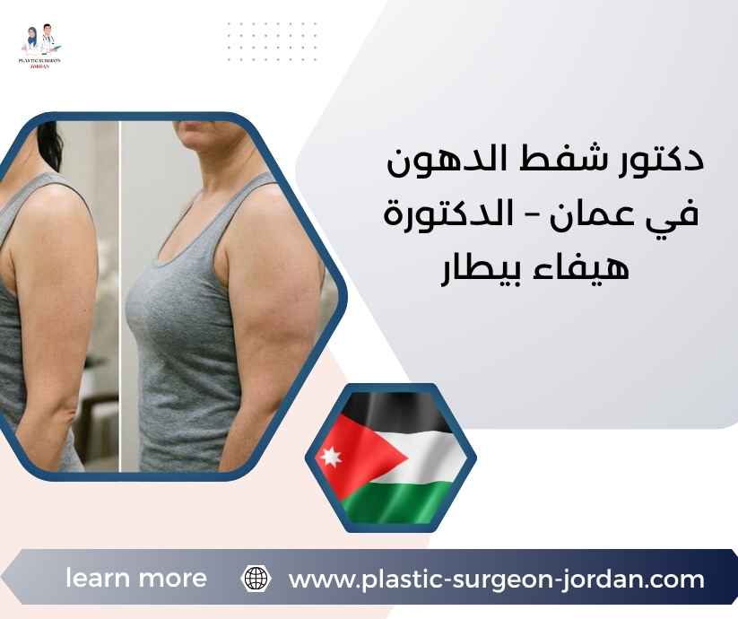 دكتور شفط الدهون في عمان – الدكتورة هيفاء بيطار دكتور شفط الدهون في عمان – الدكتورة هيفاء بيطار