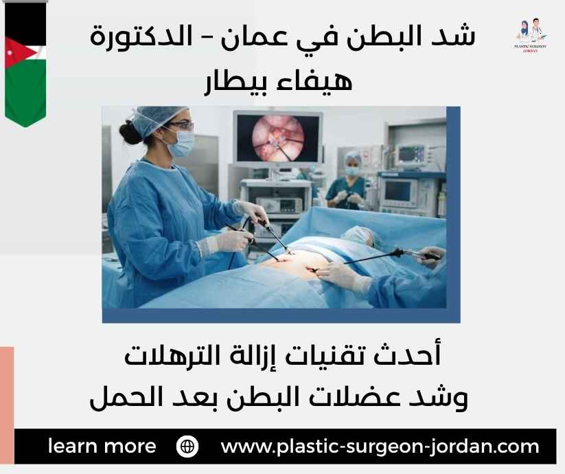 شد البطن في عمان – الدكتورة هيفاء بيطار