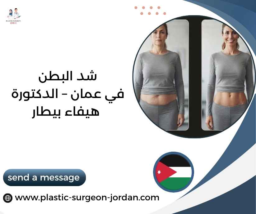 شد البطن في عمان – الدكتورة هيفاء بيطار شد البطن في عمان – الدكتورة هيفاء بيطار