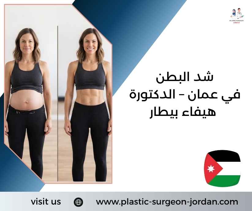 شد البطن في عمان – الدكتورة هيفاء بيطار شد البطن في عمان – الدكتورة هيفاء بيطار