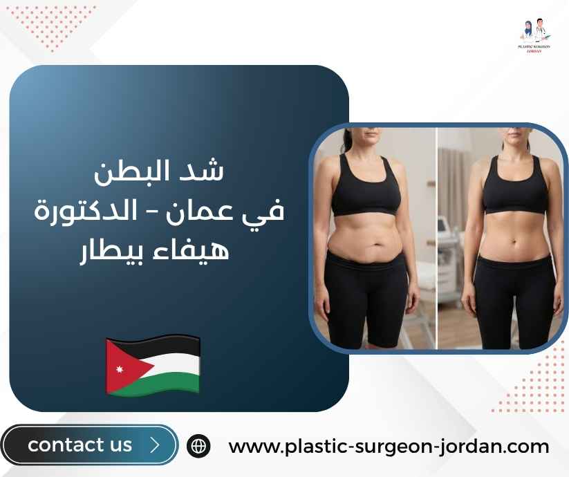 شد البطن في عمان – الدكتورة هيفاء بيطار شد البطن في عمان – الدكتورة هيفاء بيطار